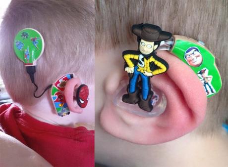 Un padre se tatúa un implante coclear para apoyar a su hija Implantes cocleares personalizados