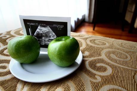 Las mujeres embarazadas de Australia no siguen las recomendaciones nutricionales Dieta en el embarazo