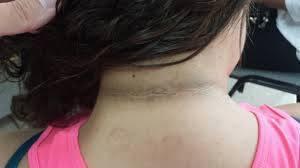 ALERTA A MANCHAS Foto de Canal10nicaragua.