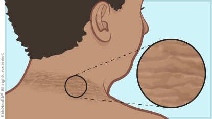 ALERTA A MANCHAS Foto de Canal10nicaragua.