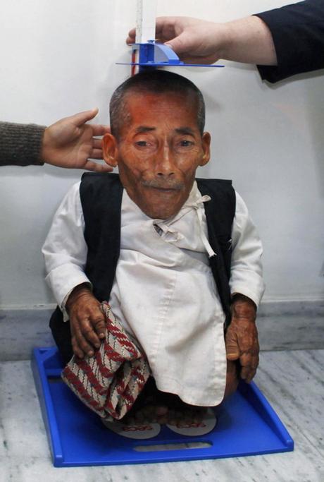 Chandra Bahadur Dangi was 21.5 inches tall.