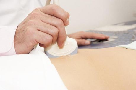 ¿Qué es el embarazo molar, y cómo puede usted reconocerlo? ¿Qué es el embarazo molar, y cómo puede usted reconocerlo?