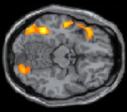Investigan las regiones cerebrales encargadas de la lectura y su conexión con el lenguaje hablado y el reconocimiento facial Investigan las regiones cerebrales encargadas de la lectura y su conexión con el lenguaje hablado y el reconocimiento facial