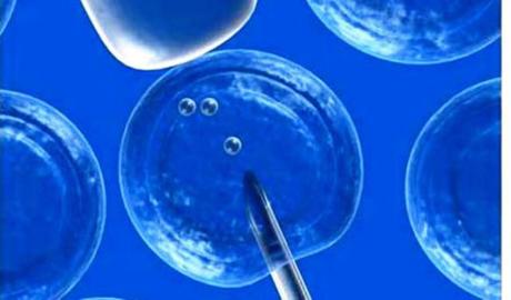 Argentina. Una pareja accedió al tratamiento de reproducción asistida por intervención del Defensor del Pueblo 000538192-fertilizacion