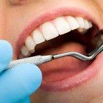 Signos de enfermedad periodontal: ¿Qué debe usted buscar?