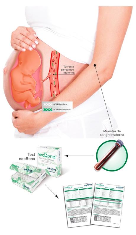 Test prenatal no invasivo: Neobona