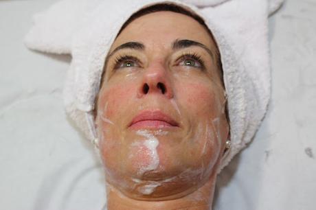 SEGUIMOS CON MI TRATAMIENTO DE INDIBA EN +SALUD +BELLEZA SEGUIMOS CON MI TRATAMIENTO DE INDIBA EN +SALUD +BELLEZA