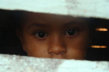 Los pediatras de Estados Unidos preguntarán a los niños si pasan hambre Malnutrición infantil