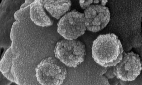 Nanoparticulas magneticas, buscan la aplicacion localizada de farmacos mediante este sistema.