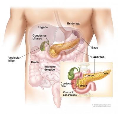 Síntomas del cáncer de Páncreas, el silencioso