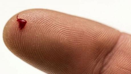 Obtén un diagnóstico de cáncer con una sola gota de sangre Obtén un diagnóstico de cáncer con una sola gota de sangre