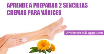 Cremas Caseras para las Varices Cremas Naturales para las Varices