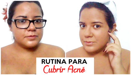 Cubrir el acné con maquillaje