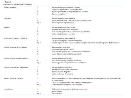 Hiperandrogenismo: Síndrome del Ovario Poliquístico.