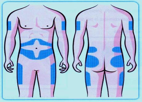 Tratamiento farmacológico de la diabetes mellitus Tratamiento farmacológico de la diabetes mellitus