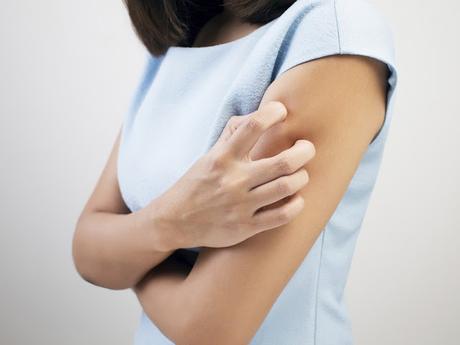 Todo lo que debes saber sobre los parabenos parabenos, picores