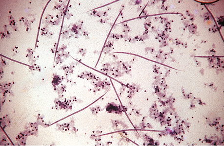 Vista en el microscopio de la Dirofilaria immitis conocida como gusanos del corazón