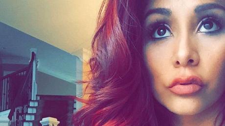 Snooki comparte una foto de su tratamiento de inyección de labios Snooki comparte una foto de su tratamiento de inyección de labios