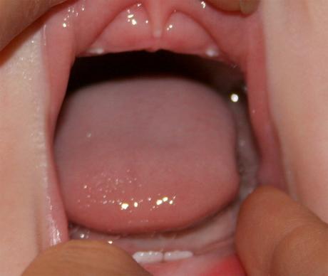 Investigación sobre los dientes de leche