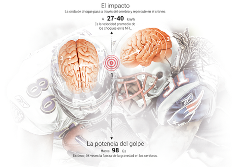 Bennet Omalu, La Encefalopatía Traumática Crónica (ETC) y La verdad duele (Concussion) Bennet Omalu, La Encefalopatía Traumática Crónica (ETC) y La verdad duele (Concussion)
