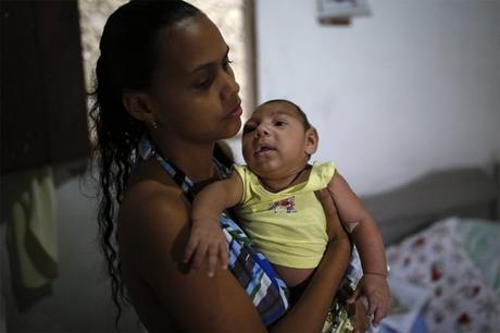 El virus zika infecta las células madre responsables de la corteza cerebral Virus zika