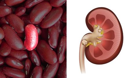 Frutas y verduras: alimentos beneficiosos similares a nuestro cuerpo fagioli reni