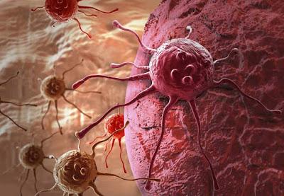 Investigadores Españoles crean un generador de pulsos para destruir tumores Investigadores Españoles crean un generador de pulsos para destruir tumores