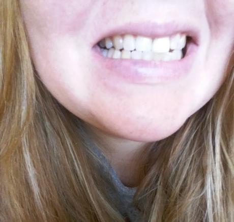 Cómo Blanquear tus dientes sin pagarle un centavo al Dentista Cómo Blanquear tus dientes sin pagarle un centavo al Dentista