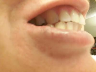 Cómo Blanquear tus dientes sin pagarle un centavo al Dentista Cómo Blanquear tus dientes sin pagarle un centavo al Dentista