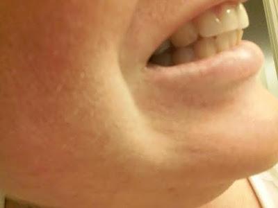 Cómo Blanquear tus dientes sin pagarle un centavo al Dentista Cómo Blanquear tus dientes sin pagarle un centavo al Dentista