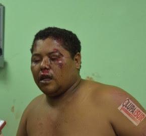 Joven del Tanque de Neiba sufre accidente en Barahona.