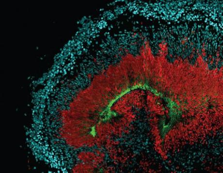 Descubierta una proteína que vincula el virus zika con la microcefalia Zika y microcefalia