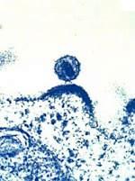 hiv leaving a cell Cura del VIH con células madre   realmente?