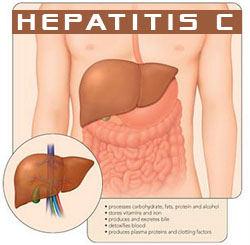España paga 13.000 euros por fármacos para la hepatitis C que cuesta 115 fabricarlos Hepatitis c sovaldi gilead