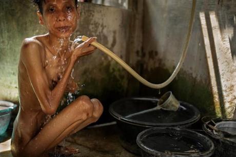Viviendo en el infierno: 19 mil personas con trastornos mentales son encerradas y encadenadas en Indonesia Viviendo en el infierno: 19 mil personas con trastornos mentales son encerradas y encadenadas en Indonesia
