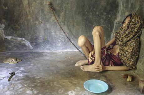 Viviendo en el infierno: 19 mil personas con trastornos mentales son encerradas y encadenadas en Indonesia Viviendo en el infierno: 19 mil personas con trastornos mentales son encerradas y encadenadas en Indonesia