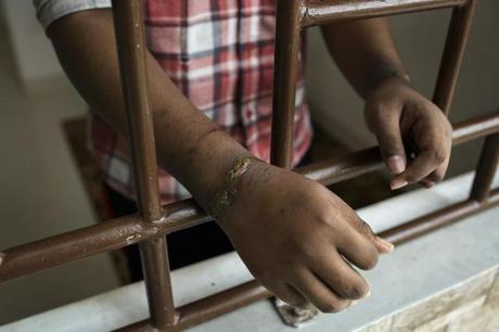 Viviendo en el infierno: 19 mil personas con trastornos mentales son encerradas y encadenadas en Indonesia Viviendo en el infierno: 19 mil personas con trastornos mentales son encerradas y encadenadas en Indonesia