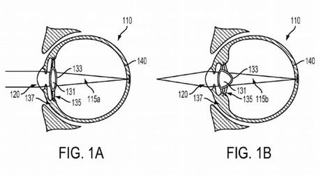 La nueva patente de Google revela un sistema para inyectarnos un ordenador en el ojo La nueva patente de Google revela un sistema para inyectarnos un ordenador en el ojo