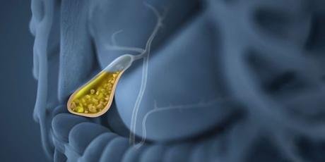 Los ataques de la vesícula biliar son aterradoras y a menudo son descritos como uno de los peores dolores Los ataques de la vesícula biliar son aterradoras y a menudo son descritos como uno de los peores dolores