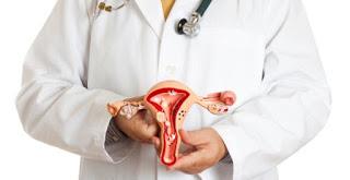 Cómo detectar a tiempo el Cáncer de Ovarios - Síntomas