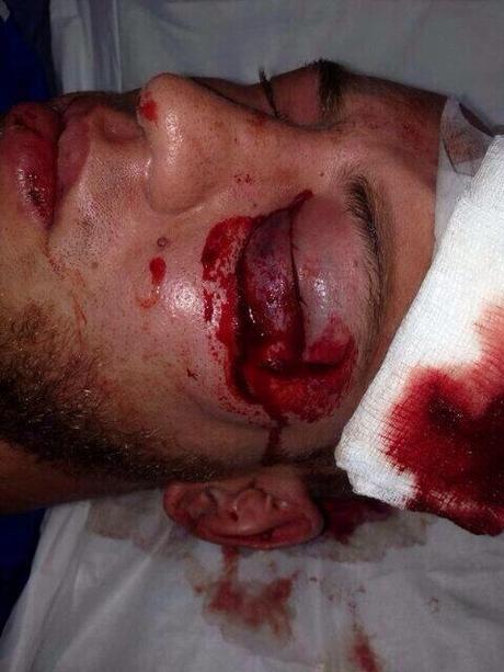 Represión brutal en Venezuela ahora!