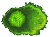 Administrar doble dosis de vacuna previene mejor la varicela Administrar doble dosis de vacuna previene mejor la varicela