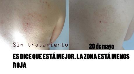 3º Tester BDV Farma .- Cosmética y Dietética Farmacéutica. Medicina Alternativa : Funciona salud, belleza, cosmética, medicina alternativa, dietética, cosmética farmaceutica, Dietética Farmaceutica, BDV Farma, cosmética natural, blog de belleza, blog de cosmética, solo yo, blog solo yo, belleza, antiedad, acne, flacidez, bolsas, ojeras, arrugas, lineas de expresión, dermocosmética, complementos alimenticios, capilar, limpieza facial, perfumes, sequedad cutánea, manchas, cicatrices, envejecimiento de la piel, antiarrugas, puntos negros, piel atópica, articulaciones, cartilago, flexibilidad,