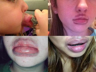 kylie-jenner-lip-fails-main