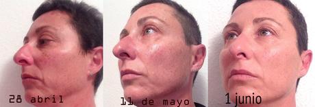 4º Tester BDV Farma .- Cosmética y Dietética Farmacéutica. Medicina Alternativa : Funciona ADIOS A LAS ARRUGAS salud, belleza, cosmética, medicina alternativa, dietética, cosmética farmaceutica, Dietética Farmaceutica, BDV Farma, cosmética natural, blog de belleza, blog de cosmética, solo yo, blog solo yo, belleza, antiedad, acne, flacidez, bolsas, ojeras, arrugas, lineas de expresión, dermocosmética, complementos alimenticios, capilar, limpieza facial, perfumes, sequedad cutánea, manchas, cicatrices, envejecimiento de la piel, antiarrugas, puntos negros, piel atópica, articulaciones, cartilago, flexibilidad,