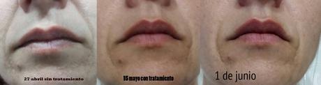 4º Tester BDV Farma .- Cosmética y Dietética Farmacéutica. Medicina Alternativa : Funciona ADIOS A LAS ARRUGAS salud, belleza, cosmética, medicina alternativa, dietética, cosmética farmaceutica, Dietética Farmaceutica, BDV Farma, cosmética natural, blog de belleza, blog de cosmética, solo yo, blog solo yo, belleza, antiedad, acne, flacidez, bolsas, ojeras, arrugas, lineas de expresión, dermocosmética, complementos alimenticios, capilar, limpieza facial, perfumes, sequedad cutánea, manchas, cicatrices, envejecimiento de la piel, antiarrugas, puntos negros, piel atópica, articulaciones, cartilago, flexibilidad,