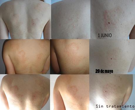 4º Tester BDV Farma .- Cosmética y Dietética Farmacéutica. Medicina Alternativa : Funciona ADIOS A LAS ARRUGAS salud, belleza, cosmética, medicina alternativa, dietética, cosmética farmaceutica, Dietética Farmaceutica, BDV Farma, cosmética natural, blog de belleza, blog de cosmética, solo yo, blog solo yo, belleza, antiedad, acne, flacidez, bolsas, ojeras, arrugas, lineas de expresión, dermocosmética, complementos alimenticios, capilar, limpieza facial, perfumes, sequedad cutánea, manchas, cicatrices, envejecimiento de la piel, antiarrugas, puntos negros, piel atópica, articulaciones, cartilago, flexibilidad,