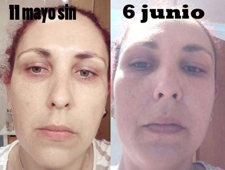 4º Tester BDV Farma .- Cosmética y Dietética Farmacéutica. Medicina Alternativa : Funciona ADIOS A LAS ARRUGAS salud, belleza, cosmética, medicina alternativa, dietética, cosmética farmaceutica, Dietética Farmaceutica, BDV Farma, cosmética natural, blog de belleza, blog de cosmética, solo yo, blog solo yo, belleza, antiedad, acne, flacidez, bolsas, ojeras, arrugas, lineas de expresión, dermocosmética, complementos alimenticios, capilar, limpieza facial, perfumes, sequedad cutánea, manchas, cicatrices, envejecimiento de la piel, antiarrugas, puntos negros, piel atópica, articulaciones, cartilago, flexibilidad,