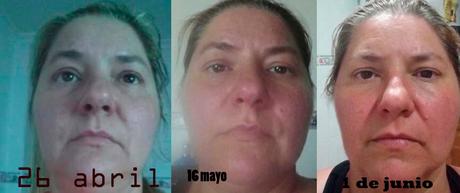 4º Tester BDV Farma .- Cosmética y Dietética Farmacéutica. Medicina Alternativa : Funciona ADIOS A LAS ARRUGAS salud, belleza, cosmética, medicina alternativa, dietética, cosmética farmaceutica, Dietética Farmaceutica, BDV Farma, cosmética natural, blog de belleza, blog de cosmética, solo yo, blog solo yo, belleza, antiedad, acne, flacidez, bolsas, ojeras, arrugas, lineas de expresión, dermocosmética, complementos alimenticios, capilar, limpieza facial, perfumes, sequedad cutánea, manchas, cicatrices, envejecimiento de la piel, antiarrugas, puntos negros, piel atópica, articulaciones, cartilago, flexibilidad,
