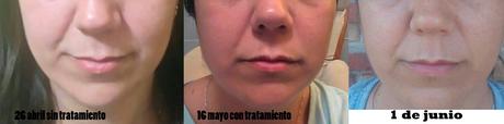 4º Tester BDV Farma .- Cosmética y Dietética Farmacéutica. Medicina Alternativa : Funciona ADIOS A LAS ARRUGAS salud, belleza, cosmética, medicina alternativa, dietética, cosmética farmaceutica, Dietética Farmaceutica, BDV Farma, cosmética natural, blog de belleza, blog de cosmética, solo yo, blog solo yo, belleza, antiedad, acne, flacidez, bolsas, ojeras, arrugas, lineas de expresión, dermocosmética, complementos alimenticios, capilar, limpieza facial, perfumes, sequedad cutánea, manchas, cicatrices, envejecimiento de la piel, antiarrugas, puntos negros, piel atópica, articulaciones, cartilago, flexibilidad,